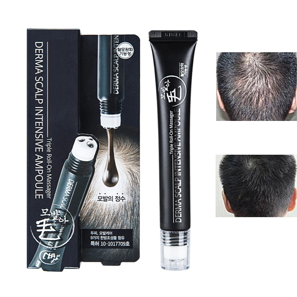 Hair-Growth-Serum Hairline Anti-Hair-Loss-Treatment Scalp Promote Natural Fast-Regrow