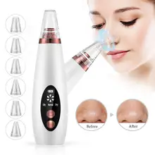 Пылесос для удаления черных точек USB электрический пылесос для черных точек Очищающая маска для лица угри, прыщи для удаления ухода за кожей лица