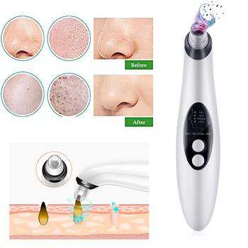 

Face Cleaner Magic 4 Treatment Heads Massager Blackhead Acne Removing Apparatus Vibration Fashion Clean Pore Pores Cleaner