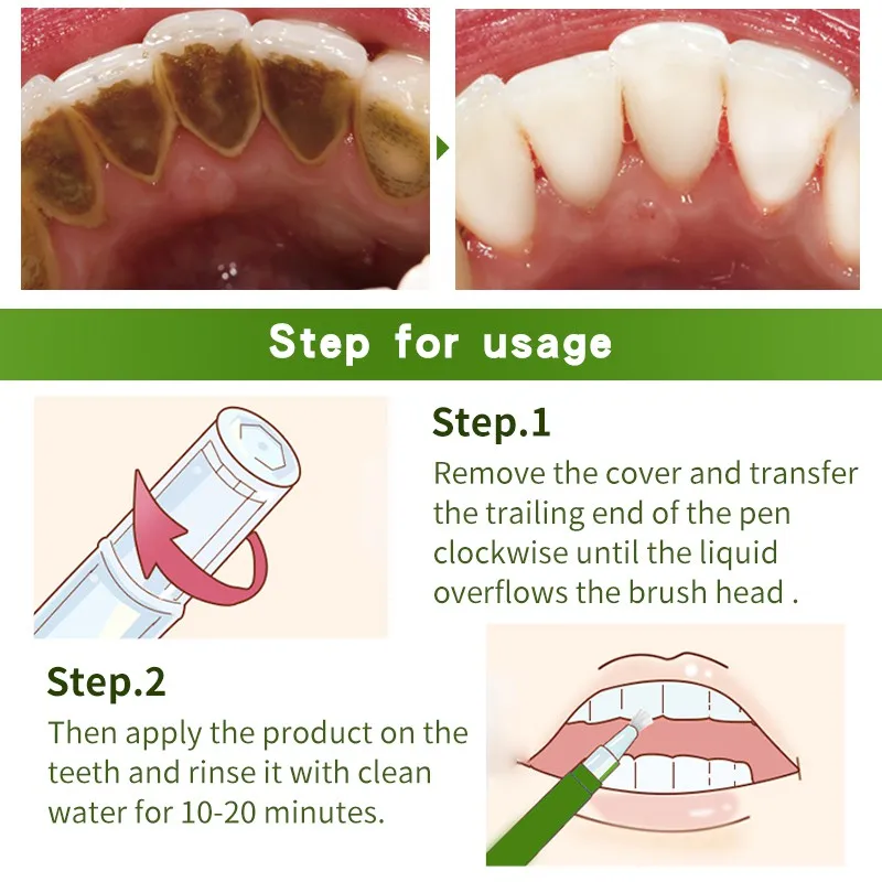 Magic Teeth Whitening Pen Removing Yellow Tooth Cleaning Dazzling White Smile | Красота и здоровье