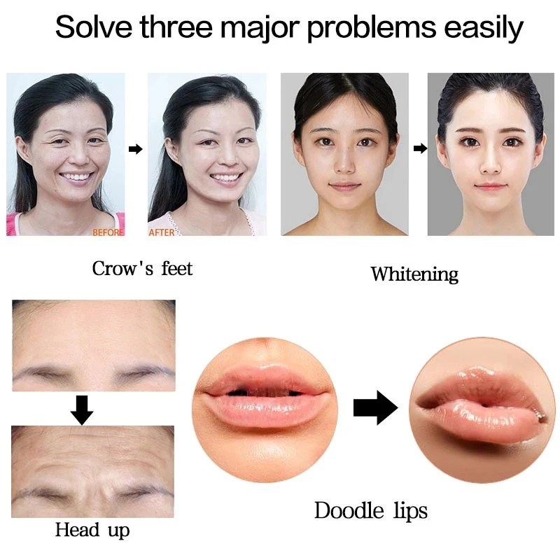 White Hyaluron Injection Pen Dermal Filler No Needle Ampoule Mesotherapy Acid Gun Anti-wrinkle Atomizer Hyaluronic Pen Injector