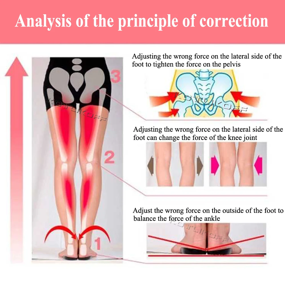 KOTLIKOFF ортопедические стельки O/X-Leg, Подошвенный Фасциит, супинатор, подстилки пятки, стельки, создающие красоту, уход за ногами