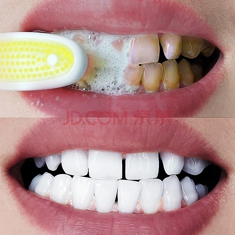 Tooth whitening tooth powder 100g, remove smoke stains, coffee stains, tea stains, freshen bad breath, oral hygiene, dental care
