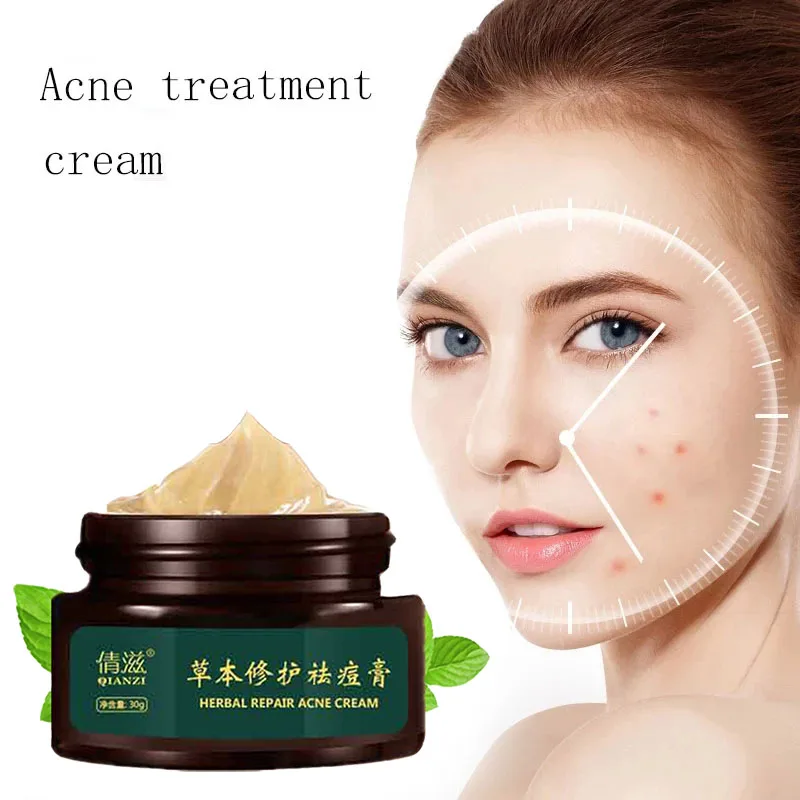 Herbal Acne Cream Anti Pimple Spot Acne Scars Blackhead Removal Cream