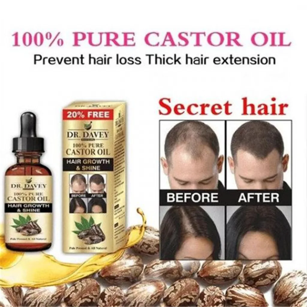 50 мл имбирь ускоренный рост волос сыворотка эфирное масло против предотвращения потери волос жидкость поврежденных волос ремонт растущих женщин мужчин# h