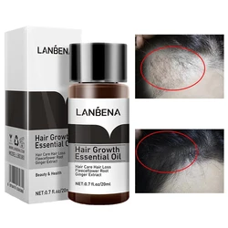 Hair Care Quick Hair Growth Essential Oil Anti-Hair Loss Liquid Anti-Dandruff Oil Control Polygonum Multiflorum Scalp Care 20ml