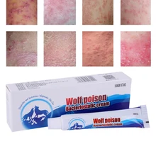 Крем для ног, пластырь для ног, быстро бактериостатический, анти-мазь против зуда, анти-пилинг, средство для ухода за китайской медициной