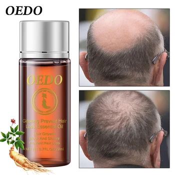 

Ginseng Hair Growth Anti-off Essential Oil Repair Damage Hair Speed Promotes Hair Growth Nourish Thick Roots Repair Dry Hair