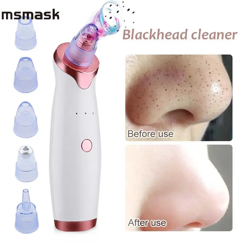 Косметический инструмент Clear Beauty Remove Blackhead белый АБС пластик оборудование для