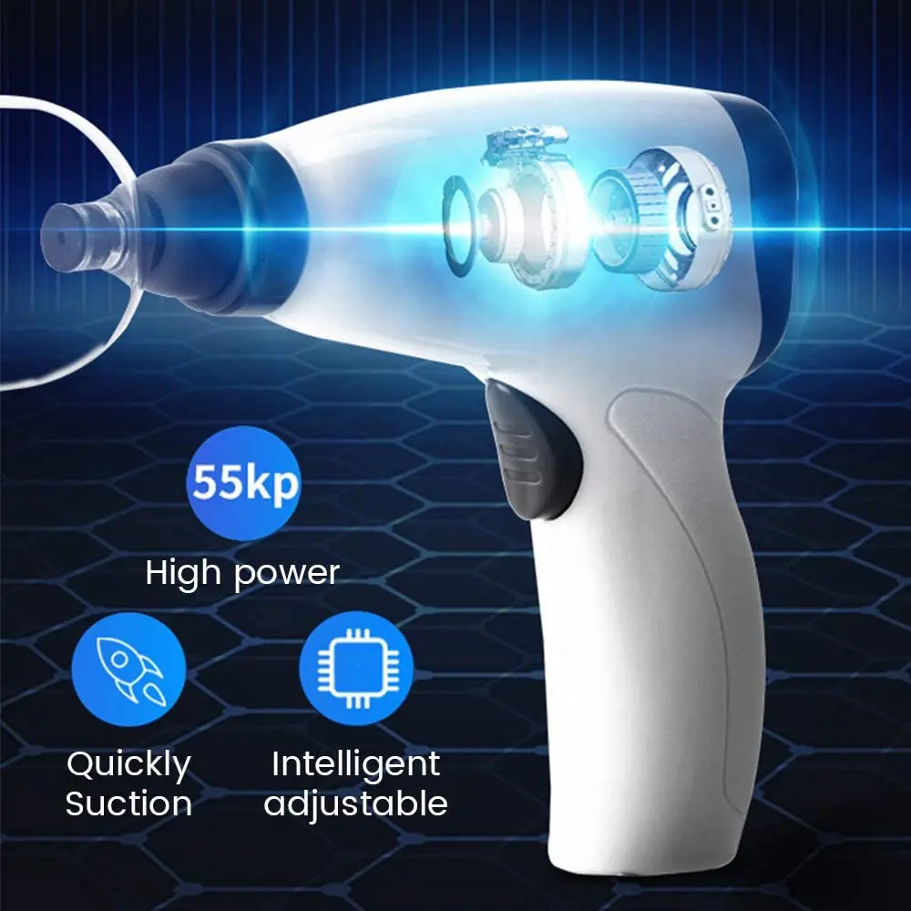 Suction Cup AntiCellulite Electric Bank Vacuum Cupping Massage Machine Therapy Set Chinese Medicine Physiotherapy Face Body Jars 3