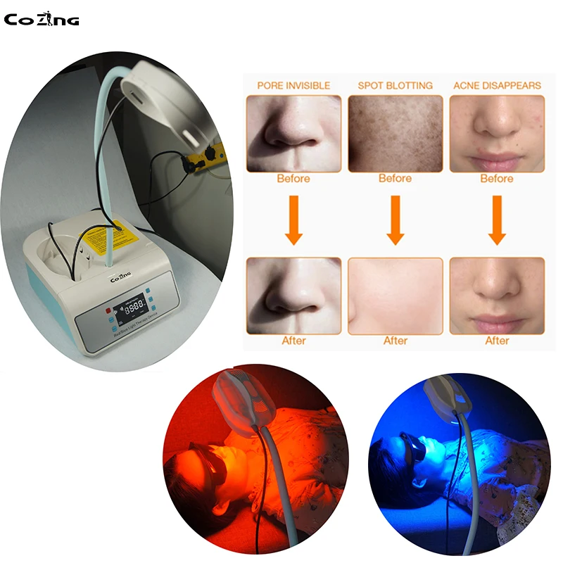 

Wound Healing Device Led Light Facial Machine LED Light Therapy Ance Skin Rejuvenation Equipment