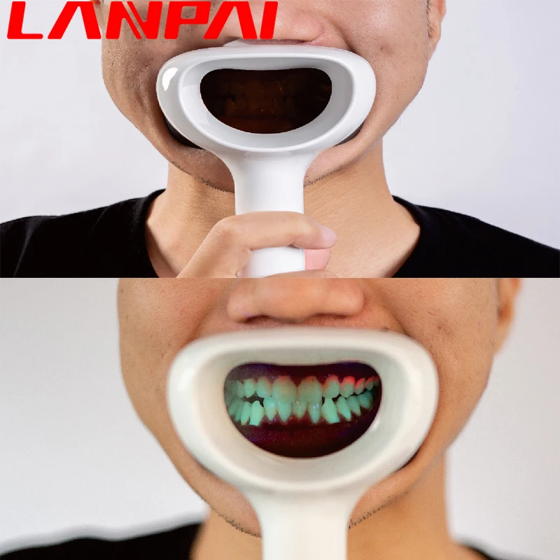 DentalPlaqueIndicatorOralDigitalObserverCheckDentalPlaqueand