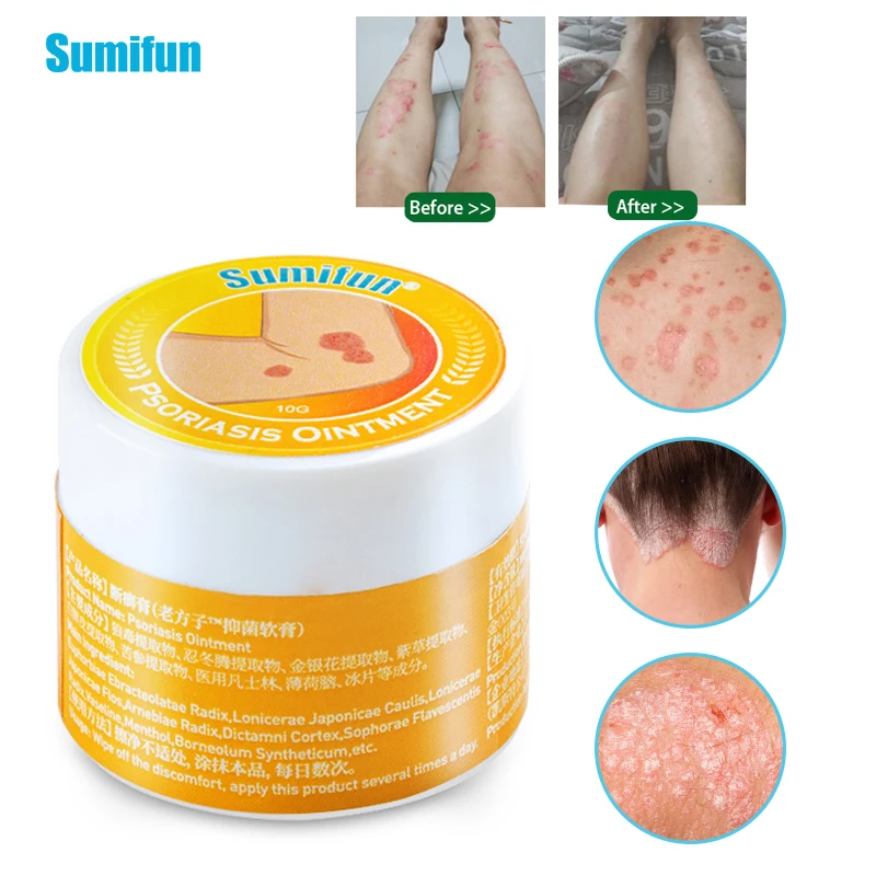 

10g Skin Psoriasis Cream Dermatitis Eczematoid EczemaTreatment Antibacterial Rash Urticaria Skin Care Chinese Herbal Ointment