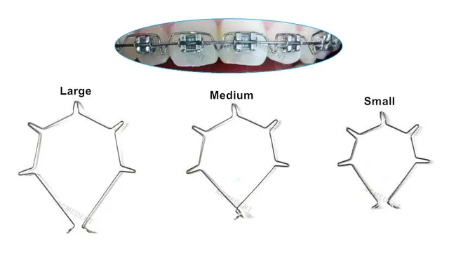 Gel Sbiancante Denti Molla A Spirale Aperta In Lega Niti Per Ortodonzia - Misura 0.010*180mm, Confezione Da 2 Pezzi, Marca AZDENT Molla 0.010x180mm - Foto 8