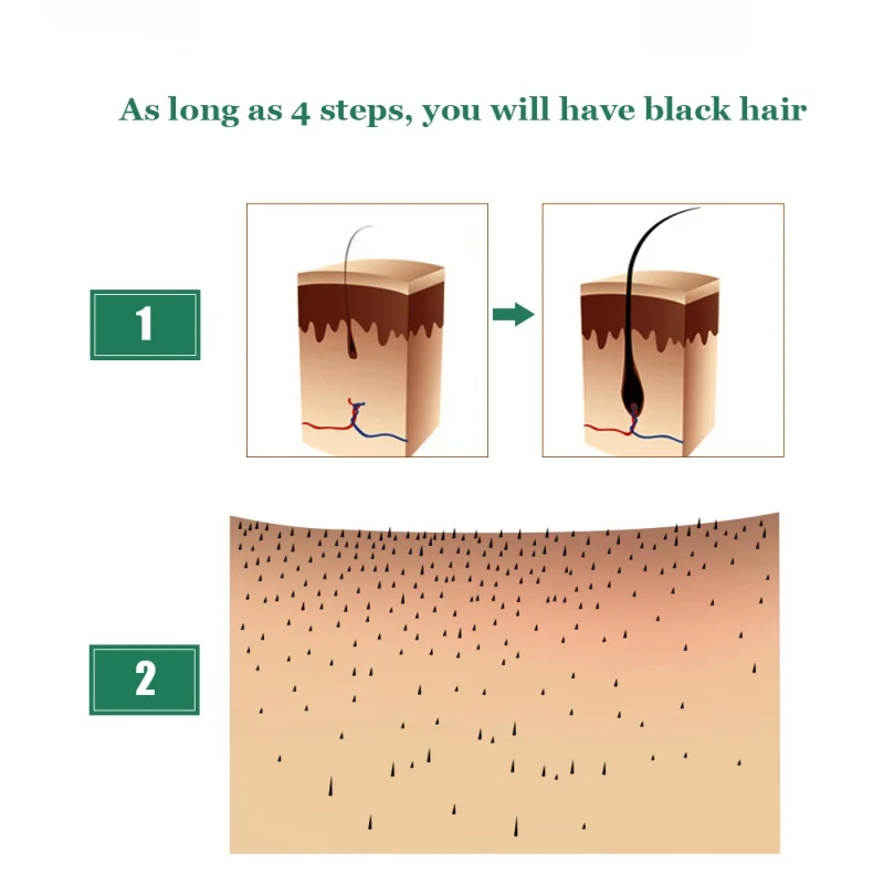 Роста волос против выпадения волос Сыворотки быстрого роста эссенция натуральные густые волосы роста жидкости без побочных эффектов продукт 7 дней роста волос Dropship