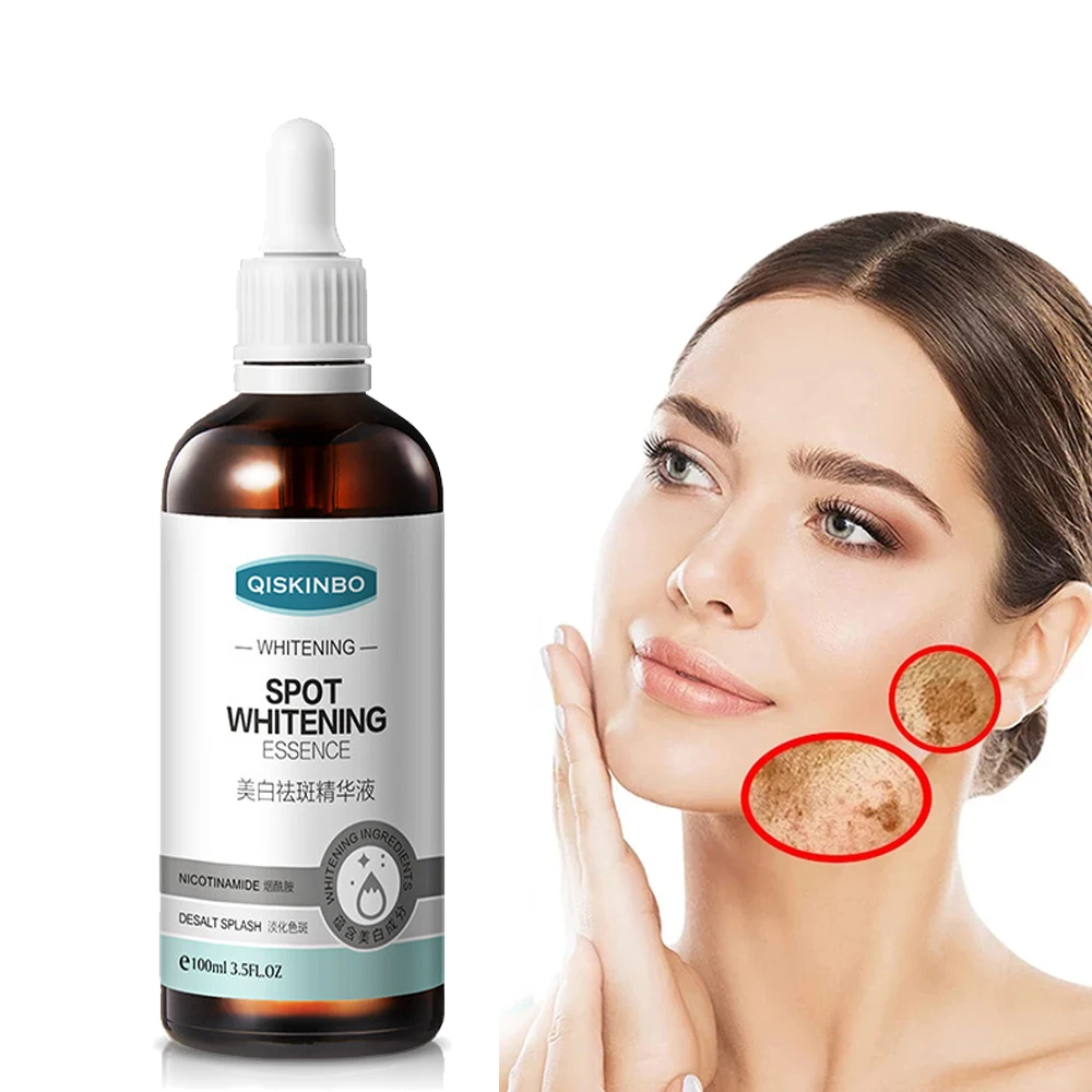 100ml Effective Whiten Freckle Cream Remove Melasma Acne Spot Pigment Melanin Dark Spots Pigmentation Gel Skin Care Essence | Красота и