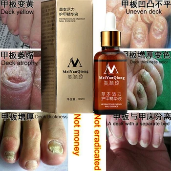 

Original Fungal Nail Treatment Essence Nail and Foot Whitening Toe Nail Fungus