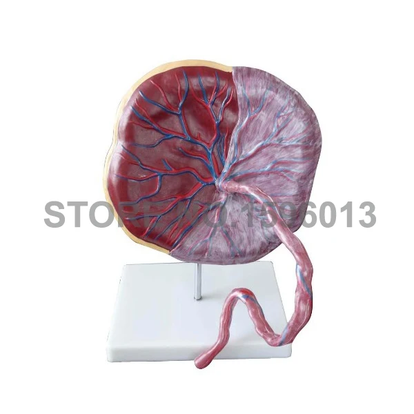 323 placenta model 2