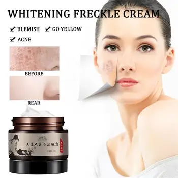 

Freckle Removal Whitening Cream Strong Effect remove freckle and dark spots Melanin Face Lift Firming Face Care Cream skin TSLM1
