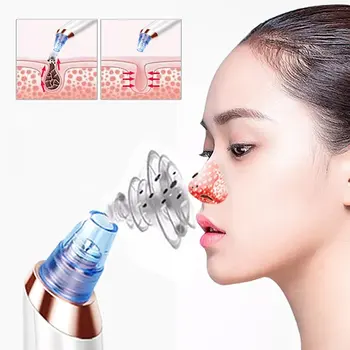

Electric Blackhead Meter Acne Facial Pore Cleaner Face Beauty Instrument Home Portable Remove Blackhead Clean Skin Tool