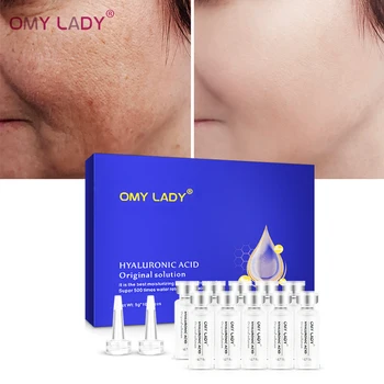 

OMY LADY Hyaluronic Acid Original Solution Facial Serum Anti Wrinkle Moisturizing Whitening Acne Treatment Face Skin Care