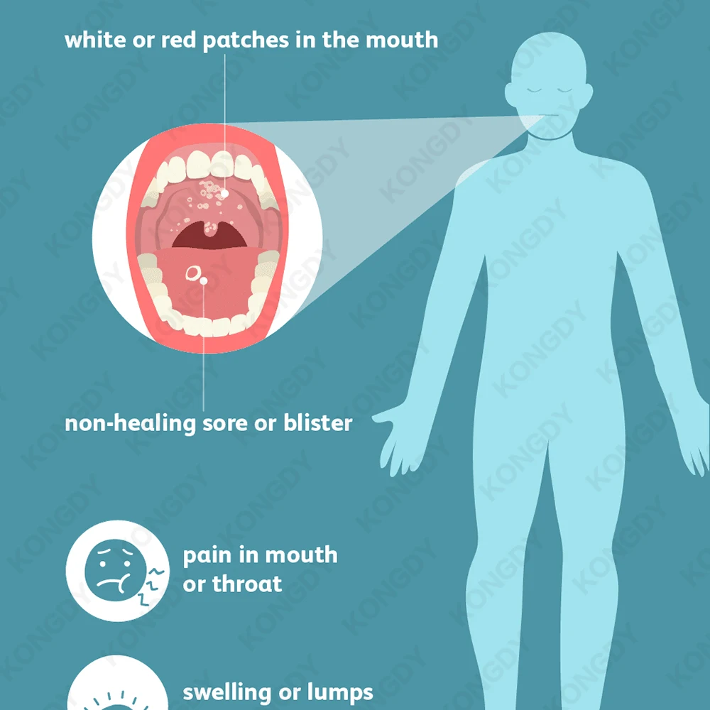 Oral Canker Sore Stickers Effective Mouth Ulcer Treatment Mouth Sole Cover Patch Fast Healing Safe Antibacterial Film 6PCS/BOX