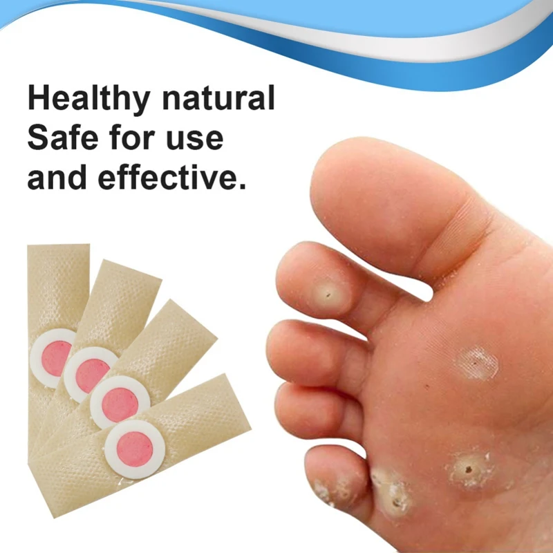 Recommend Corn Removal Patch Toe Callus Corn Remover Pads Wart Treatment Patch For Foot