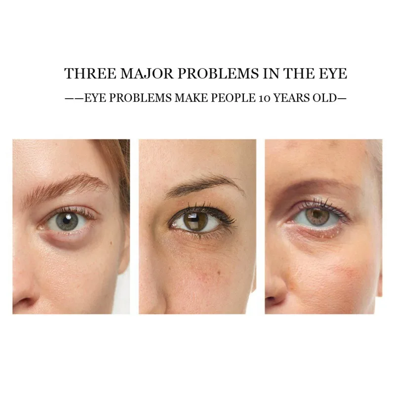 aging skin around eyes