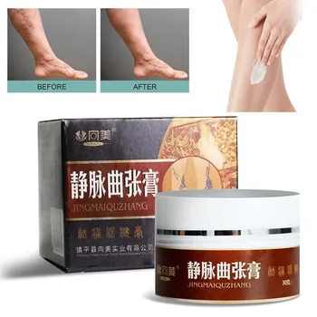 

Effective Varicose Veins Treatment Cream Varicose Vein Pain Relief Ointment Varicosity Angiitis Treatment Ointment Herbal Cream