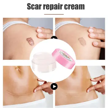 

Nuobisong Face Skin Care Treatment Face Pimples Scar Moisturizing Marks Treatment Stretch Acne Cream Removal Whitening V9G5