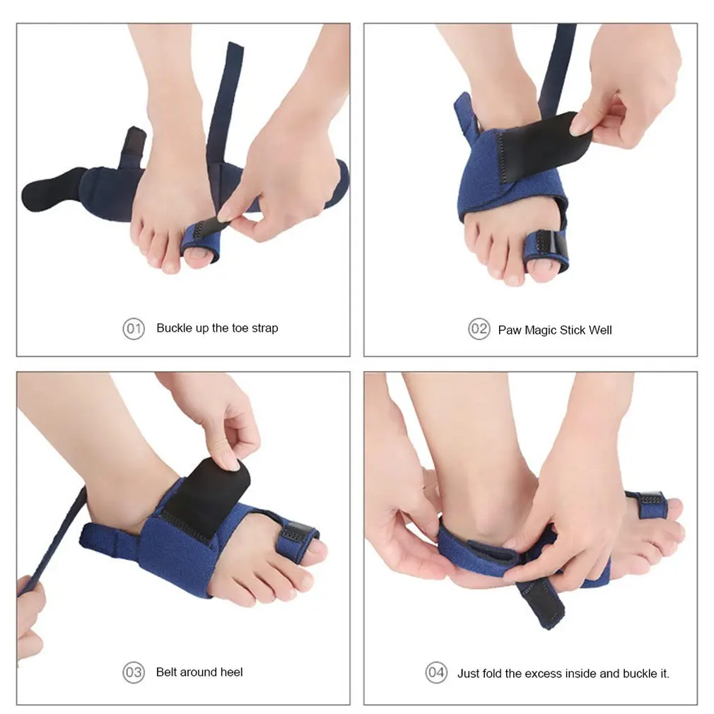 Уход за ногами Bunion Splint корректор вальгусной деформации ортопедический носок