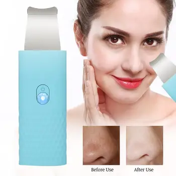

Mini Face Skin Scrubber Ultrasonic Facial Cleanser Exfoliating Remove Blackheads Pore Cleanser Tool Facial Care Tool Massage