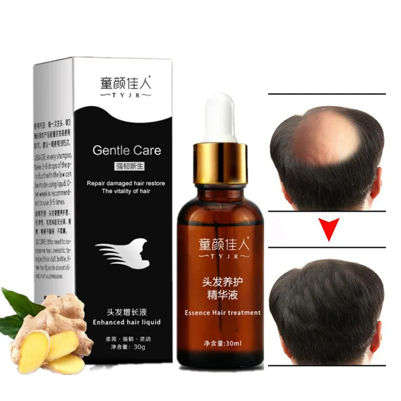 30 мл Уход За Волосами Эфирные масла для роста волос эссенция оригинальные