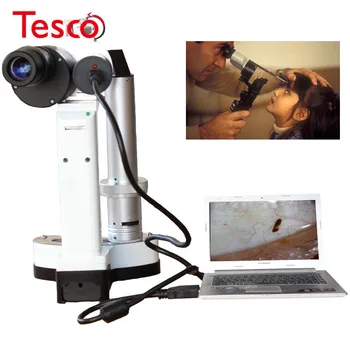 

LYL-S Portable Slit Lamp LED Bulb Portable Microscope for Pet hospital ophthalmology Camera Total 10x and 16x Magnification