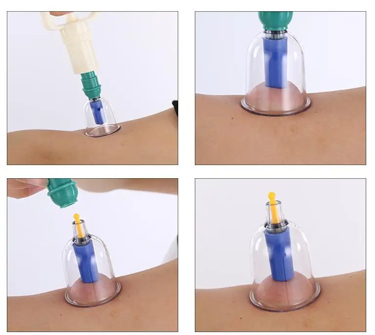 36020181217192213565