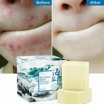 

100g Sea Salt Whitening Soap Cleaner Removal Pimple Pores Acne Treatment Goat Milk Moisturizing Face Wash Soap Skin Care