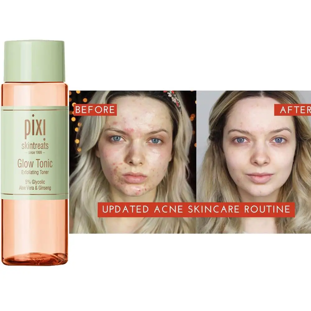 Pixi 100ML 5% Glycolic Acid Glow Tonic Moisturizing Oil-controlling Essence Toner Base Makeup Toner Is Suitable for Dry and Oily