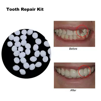 

VIBRANT GLAMOUR Resin False Teeth Solid Glue Temporary Tooth Repair Set Teeth Solid Glue Denture Adhesive Teeth Dentist