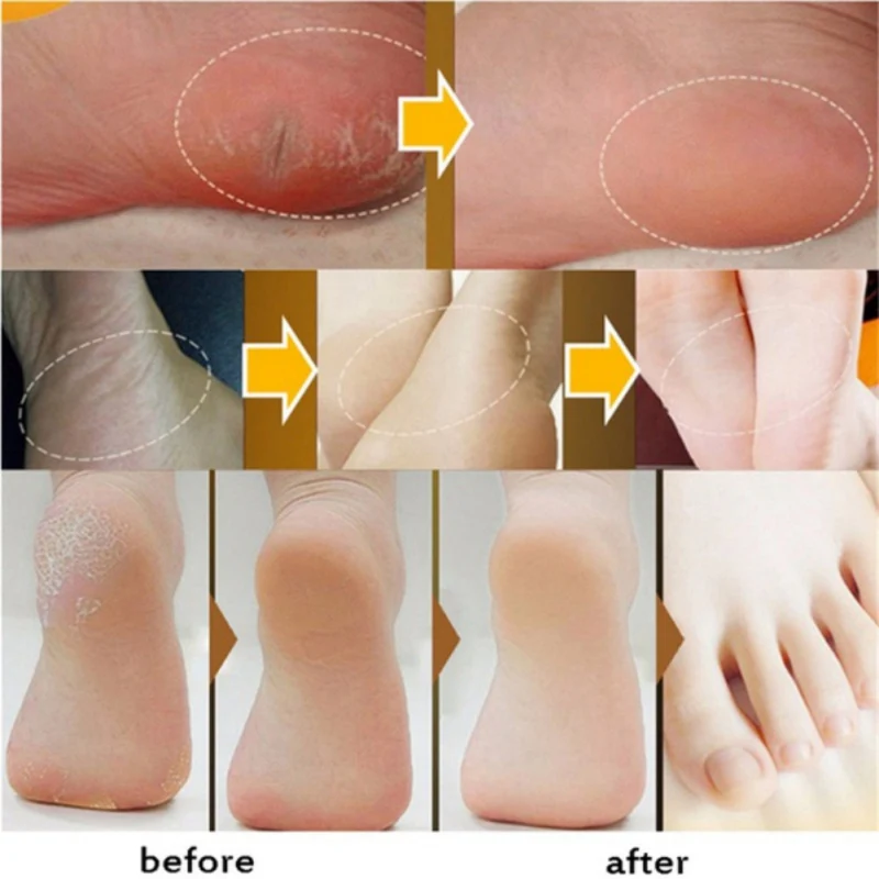 Полезный крем для ног с конским маслом, антицарапающий кожу, Восстанавливающий увлажняющий крем для шероховатой сухой и треснутой полосой пятки для ног