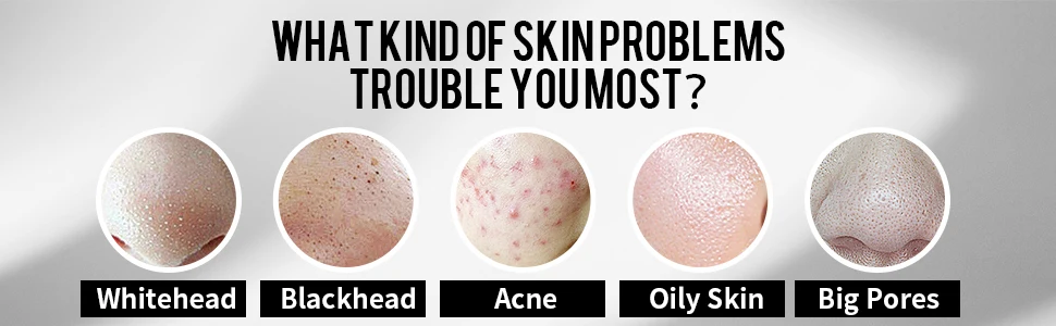 2020-5火山泥面膜970x300