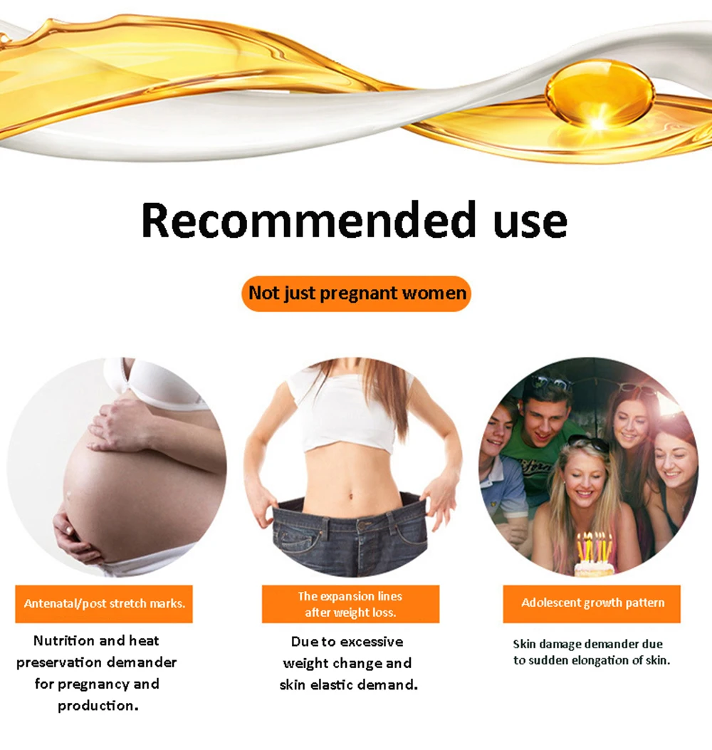 stretch marks removal oil