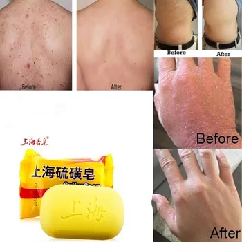 

85G Shanghai sulfur soap oil-control acne treatment blackhead remover soap Whitening cleanser Chinese traditional Skin care