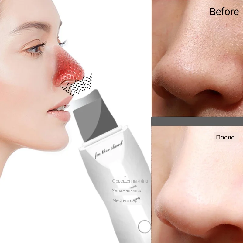 主图_Rechargeable_Ultrasonic_Face_Skin_Scrubber_Facial_Cleaner_Peeling_Vibration_Blackhead_Removal_Exf (3)