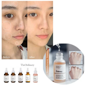 

The Ordinary Lactic Acid 10% + HA Ascorbic Acid 8% + Alpha Arbutin 2% Buffer Blemishes Remove Acne Scars Whitening Face Serum
