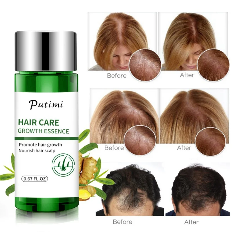 Натуральное эфирное масло для роста волос уход за волосами продукты для предотвращения выпадения волос для мужчин и женщин Простота в использовании