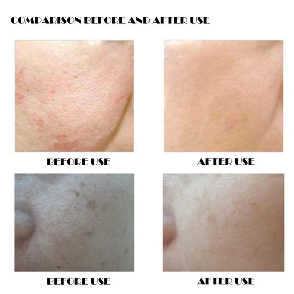 ZE659800-C-4-1 - 副本