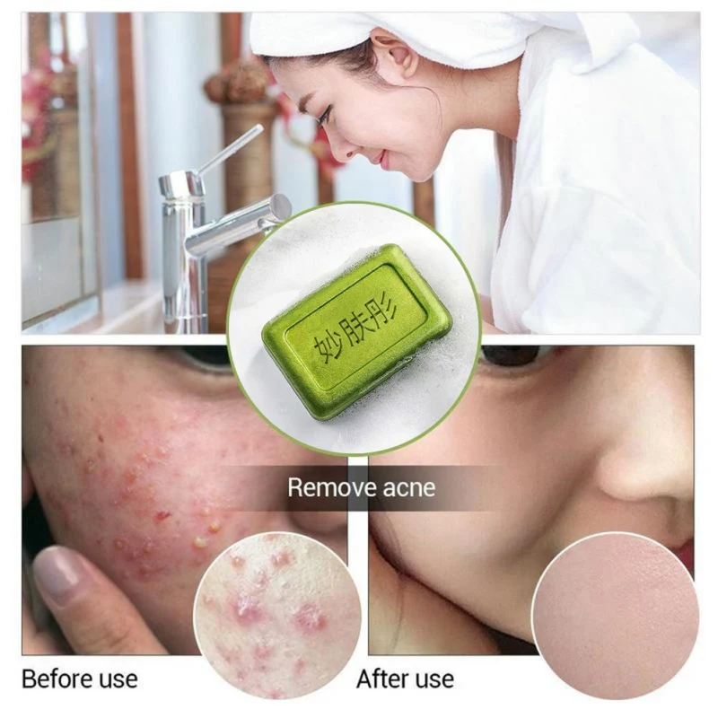 Rffective Handmade Tea Tree Oil Soap Mites Removal Soap Anti-mites Shrinking Pores Rffective Handmade Tea Tree Oil Soap Mites Removal Soap Anti-mites Shrinking Pores