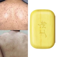 Шанхайское серное мыло, контроль над маслом, лечение акне, средство для удаления угрей, 85 г, Отбеливающее очищающее средство, китайский традиционный уход за кожей