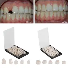 

100Pc False Dental Crown Resin Porcelain Material Temporary Teeth Crown Realistic Oral Care Teeth Whitening Anterior Molar Crown