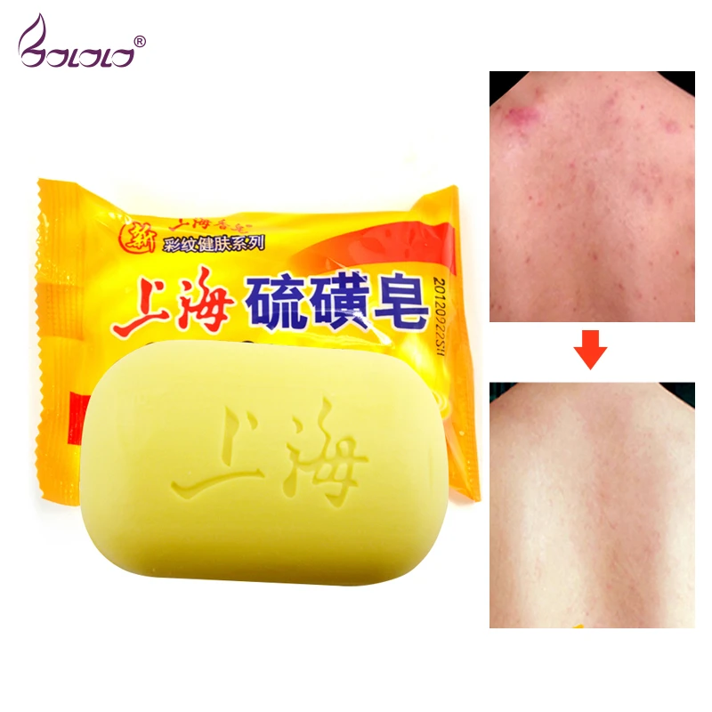 sulfur soap face wash